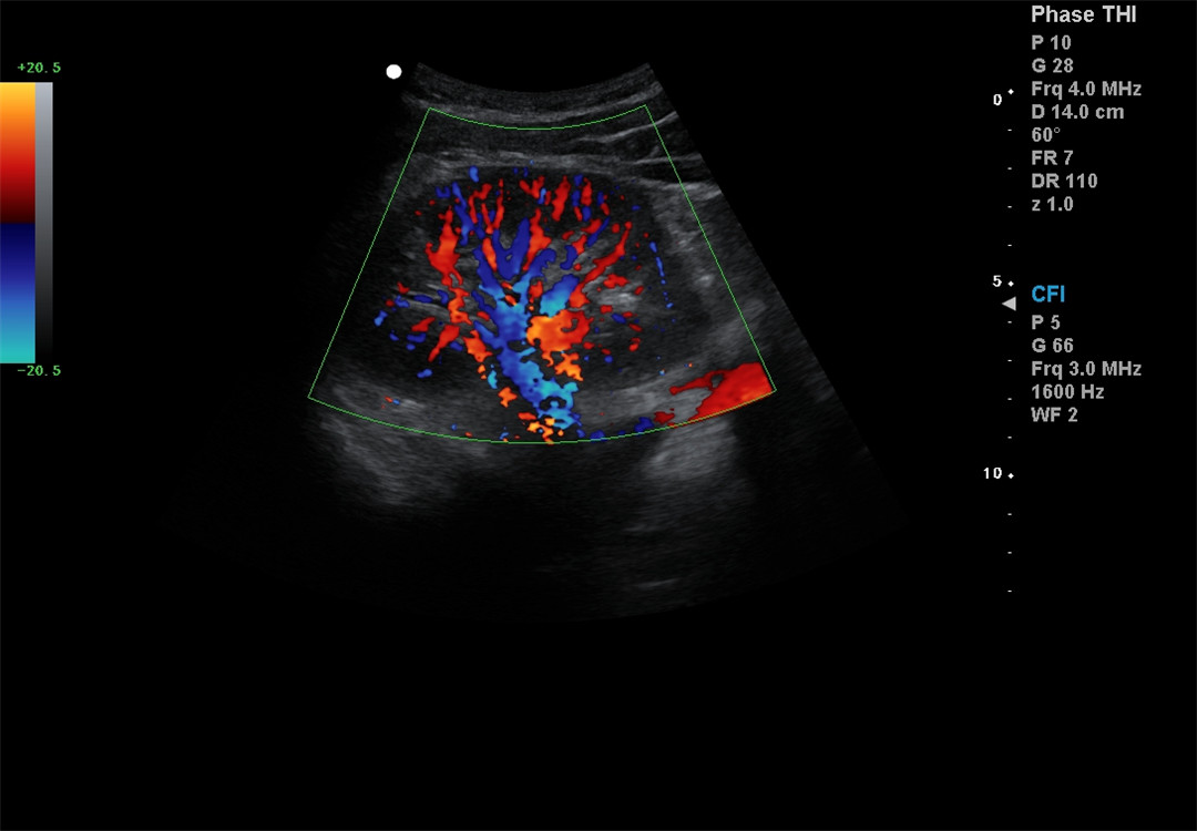 Faarf Doppler Imaging (7)