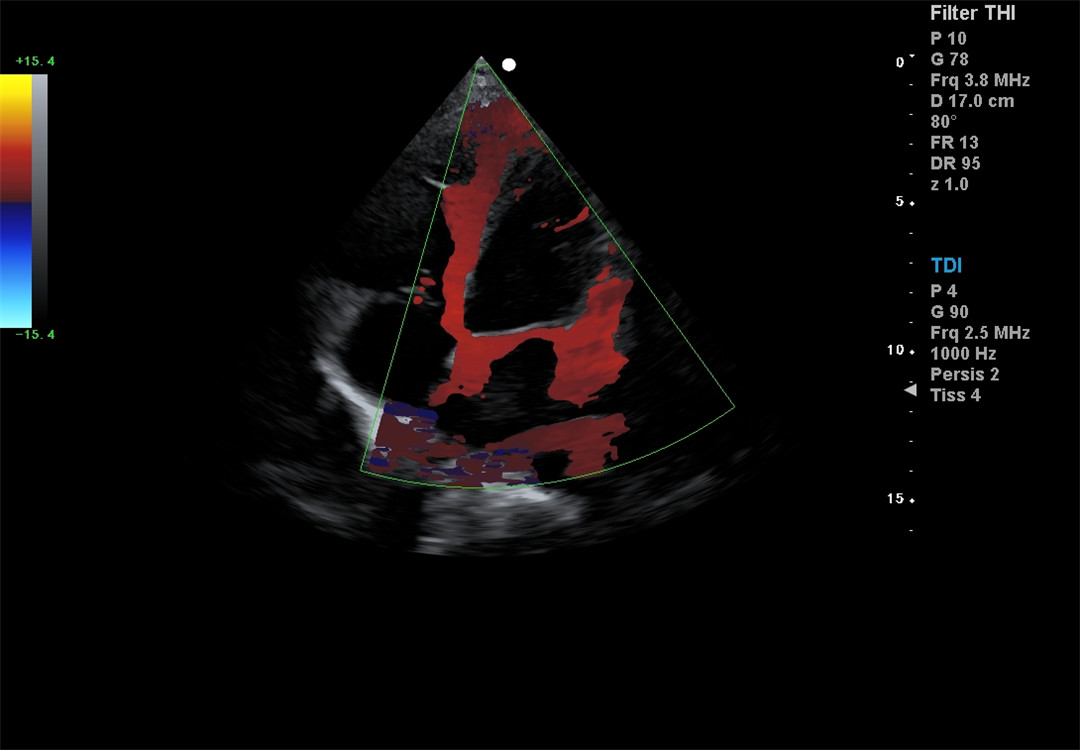 Color Doppler imaging (1)