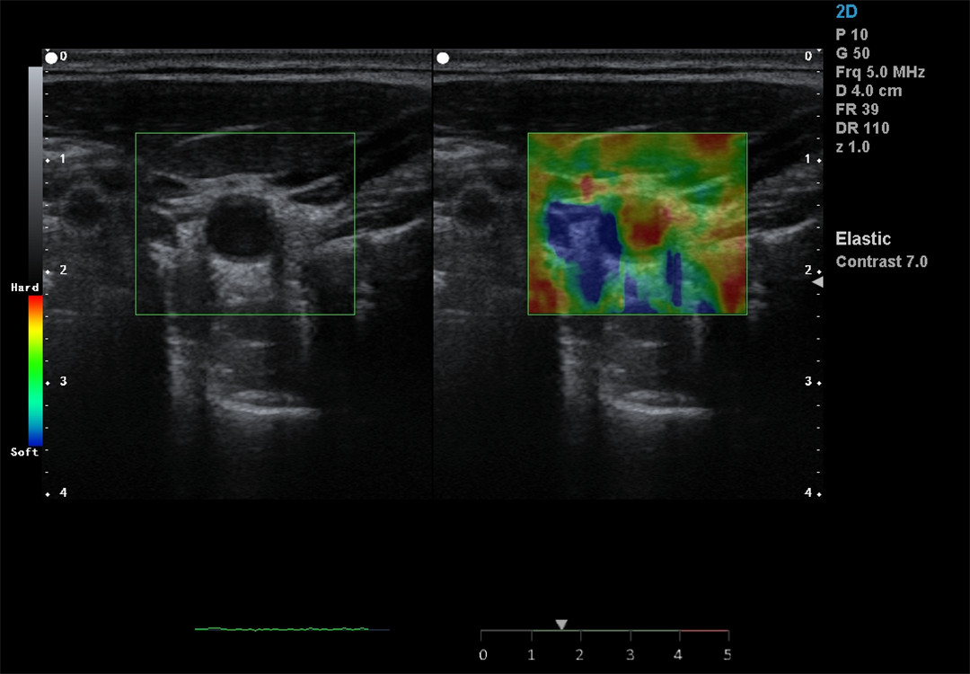 Color Doppler imaging (3)