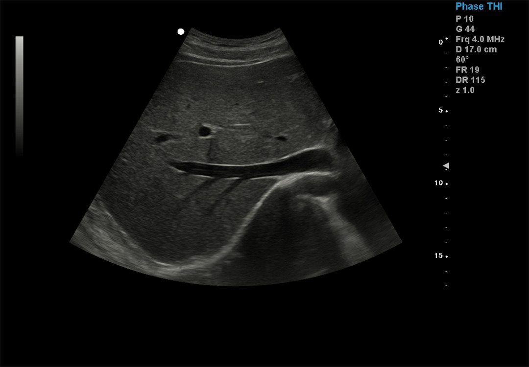 Color Doppler imaging (4)