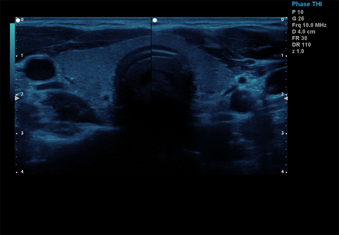 Color Doppler imaging (5)