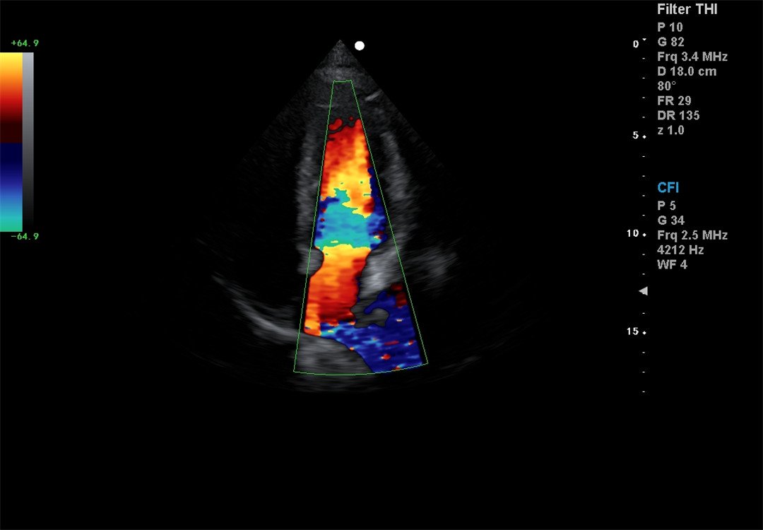 Color Doppler imaging (8)