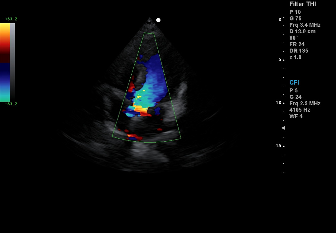 Color Doppler imaging (9)